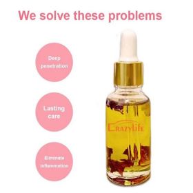 Crazylife Rose Yoni Oil Care Female Private Parts Care Rose Essential Oil 30ml (Option: Rose-30ml)